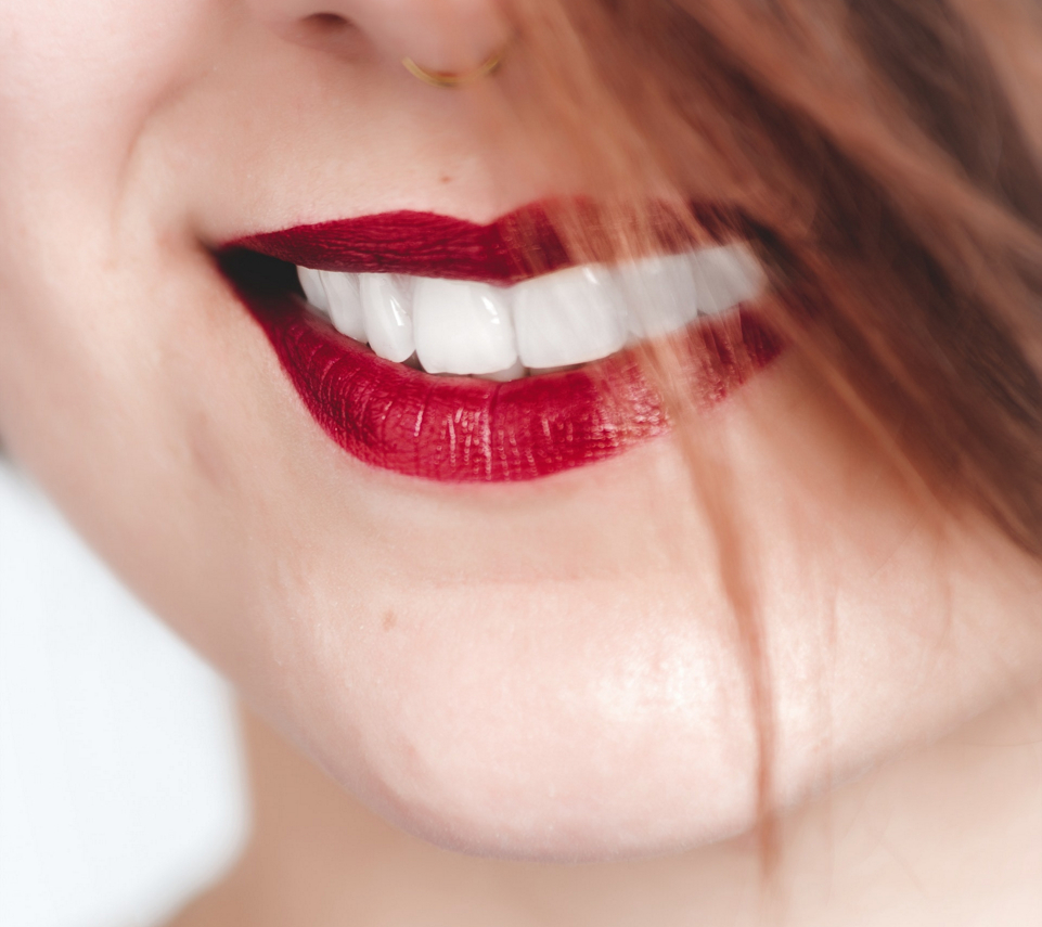 DentalEsp – Conquista tu sonrisa